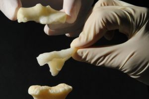Neues Biomaterial soll geschädigten Knorpel reparieren