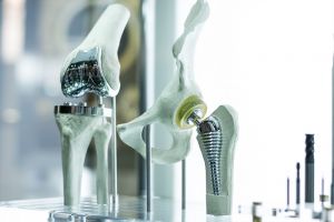 Expertenempfehlung: Zementierte Prothese ab 75 Jahren