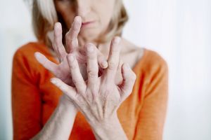Arthrose: Gelenkprothesen können Finger wieder beweglich machen