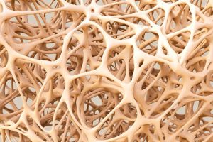 Osteoporose vorbeugen: Mit Muskeln Knochen stärken